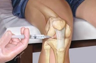 The injection of further