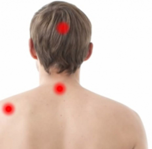 foci of degenerative disc disease