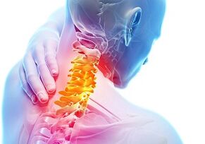 The main signs and symptoms of cervical osteochondosis