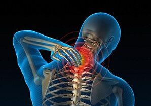 Why develop and how cervical osteochondosis manifests itself