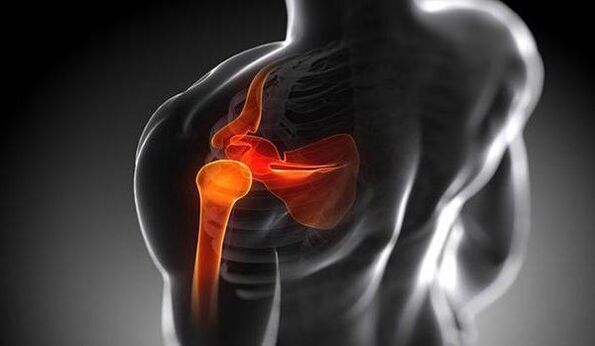 damage to the shoulder joint due to osteoarthritis
